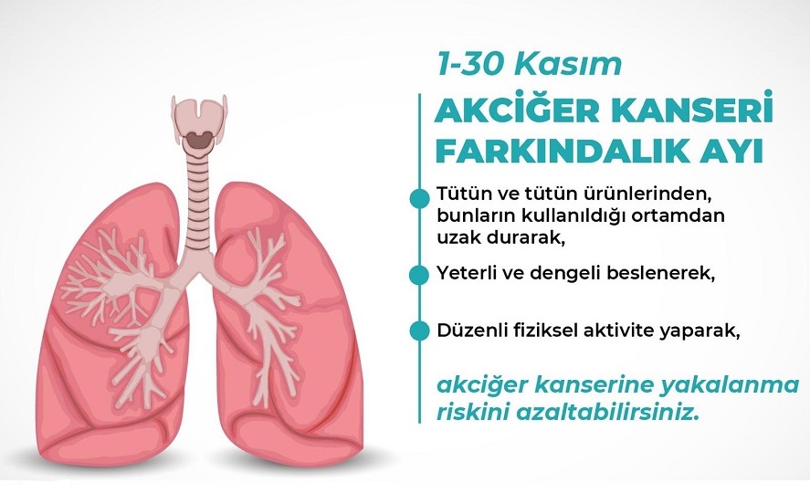 Akciğer Kanseri Farkındalık Ayı (1- 30 Kasım)